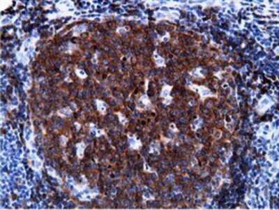 Immunohistochemistry: BCAP/PIK3AP1 Antibody (OTI7A11) - Azide and BSA Free [NBP2-72368]