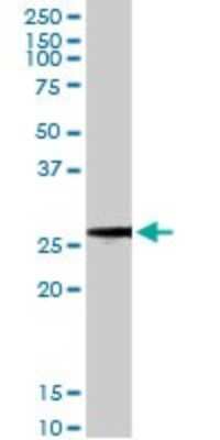 Western Blot: BCAP31 Antibody (3C5) [H00010134-M01]