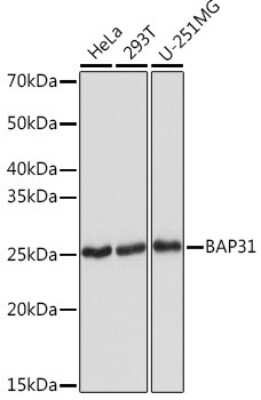 Western Blot: BCAP31 Antibody (7R10K2) [NBP3-16101]