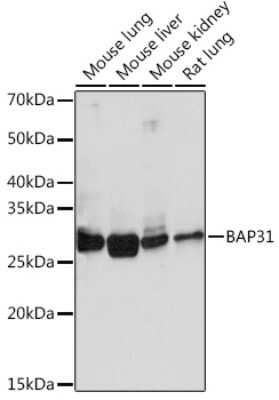 Western Blot: BCAP31 Antibody (7R10K2) [NBP3-16101]