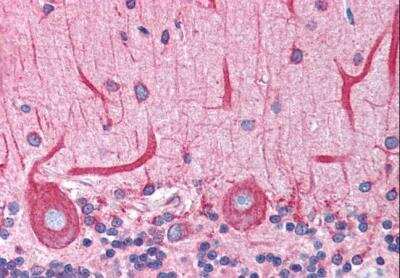 Immunohistochemistry-Paraffin: BCAP31 Antibody [NB100-1016]