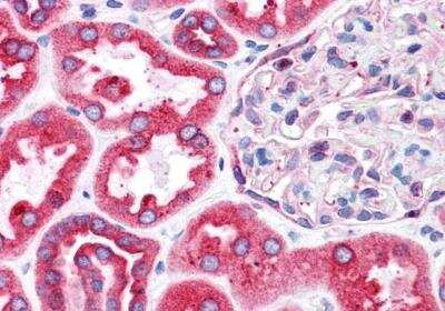 Immunohistochemistry-Paraffin: BCAP31 Antibody [NB100-1016]