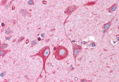 Immunohistochemistry-Paraffin: BCAP31 Antibody [NB100-1016]