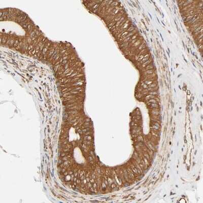 Immunohistochemistry-Paraffin: BCAP31 Antibody [NBP1-89357]