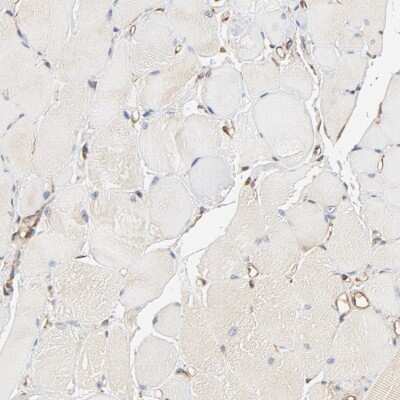 Immunohistochemistry-Paraffin: BCAP31 Antibody [NBP1-89357]