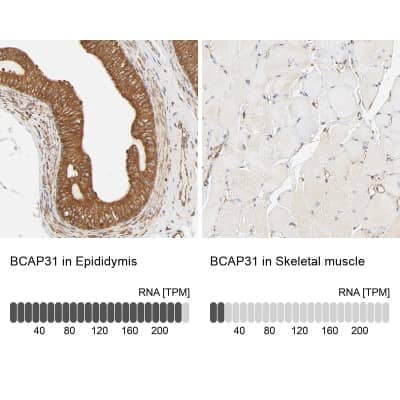 Immunohistochemistry-Paraffin: BCAP31 Antibody [NBP1-89357]