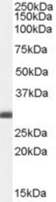 Western Blot: BCAP31 Antibody [NB100-1016]