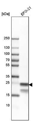 Western Blot: BCAP31 Antibody [NBP1-89357]