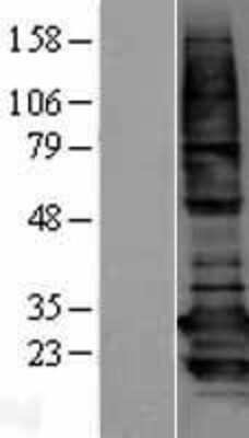 Western Blot: BCAP31 Overexpression Lysate [NBL1-07934]