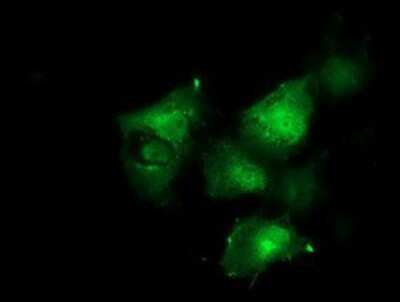 Immunocytochemistry/ Immunofluorescence: p130Cas/BCAR1 Antibody (OTI1A9) [NBP2-00532]