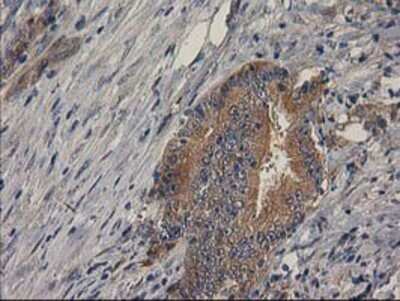 Immunohistochemistry-Paraffin: p130Cas/BCAR1 Antibody (OTI1A9) [NBP2-00532]