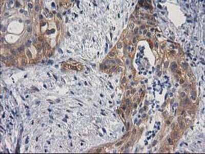 Immunohistochemistry-Paraffin: p130Cas/BCAR1 Antibody (OTI1A9) [NBP2-00532]