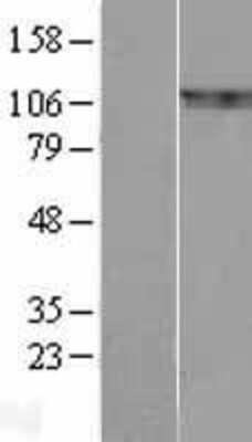 Western Blot: p130Cas/BCAR1 Overexpression Lysate [NBL1-07935]