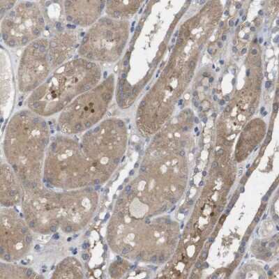Immunohistochemistry-Paraffin: BCAR3 Antibody [NBP1-82523]