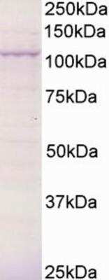 Western Blot: BCAR3 Antibody [NB300-825]