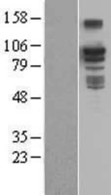 Western Blot: BCAR3 Overexpression Lysate [NBL1-07936]