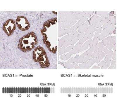 Immunohistochemistry-Paraffin: BCAS1 Antibody [NBP2-38736]