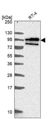 Western Blot: BCAS1 Antibody [NBP2-38658]