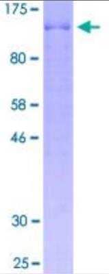 SDS-PAGE: Recombinant Human BCAS1 Protein [H00008537-P01]