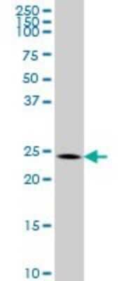 Western Blot: BCAS2 Antibody (1D10) [H00010286-M01]