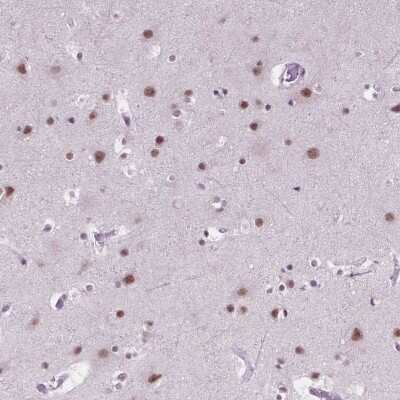 Immunohistochemistry: BCAS2 Antibody [NBP2-49532]