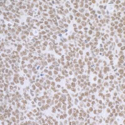 Immunohistochemistry-Paraffin: BCAS2 Antibody [NB110-40681]
