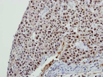 Immunohistochemistry-Paraffin: BCAS2 Antibody [NBP2-15551]