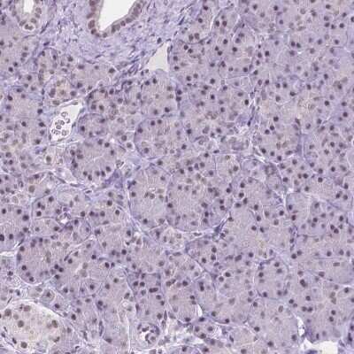 Immunohistochemistry-Paraffin: BCAS2 Antibody [NBP2-49532]