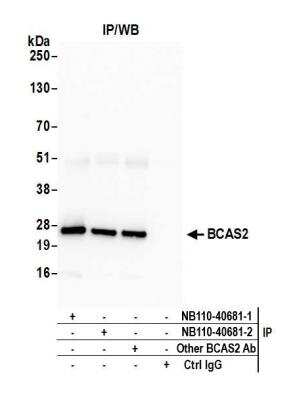 Immunoprecipitation: BCAS2 Antibody [NB110-40681]