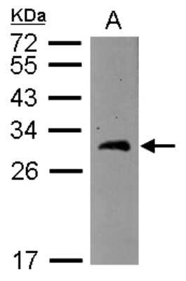 Western Blot: BCAS2 Antibody [NBP2-15551]