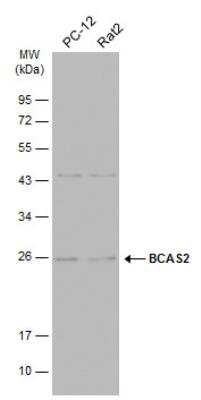 Western Blot: BCAS2 Antibody [NBP2-15551]