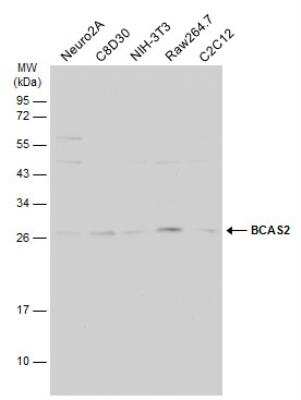 Western Blot: BCAS2 Antibody [NBP2-15551]