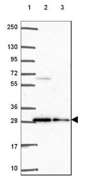 Western Blot: BCAS2 Antibody [NBP2-49532]