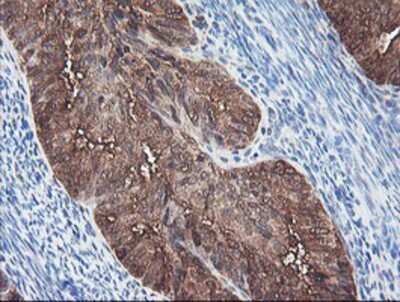 Immunohistochemistry-Paraffin: BCAT1 Antibody (OTI3F5) [NBP2-01826]