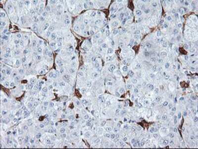 Immunohistochemistry-Paraffin: BCAT1 Antibody (OTI3F5) [NBP2-01826]