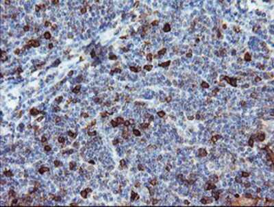 Immunohistochemistry-Paraffin: BCAT1 Antibody (OTI3F5) [NBP2-01826]