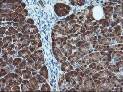 Immunohistochemistry-Paraffin: BCAT1 Antibody (OTI3F5) [NBP2-01826]