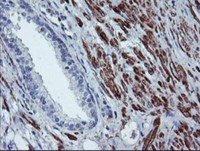 Immunohistochemistry-Paraffin: BCAT1 Antibody (OTI3F5) [NBP2-01826]