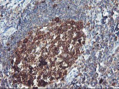 Immunohistochemistry-Paraffin: BCAT1 Antibody (OTI3F5) [NBP2-01826]