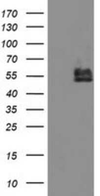 Western Blot: BCAT1 Antibody (OTI3F5) [NBP2-01826]