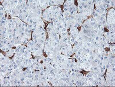 Immunohistochemistry: BCAT1 Antibody (OTI3F5) - Azide and BSA Free [NBP2-70242]