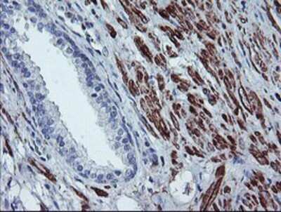 Immunohistochemistry: BCAT1 Antibody (OTI3F5) - Azide and BSA Free [NBP2-70242]
