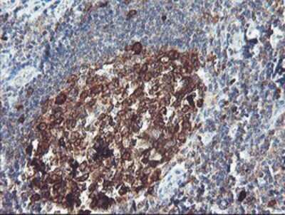 Immunohistochemistry: BCAT1 Antibody (OTI3F5) - Azide and BSA Free [NBP2-70242]