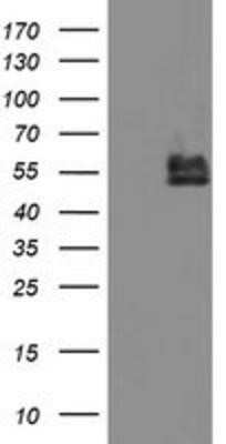 Western Blot: BCAT1 Antibody (OTI3F5)Azide and BSA Free [NBP2-70242]