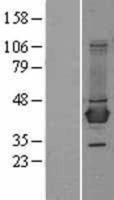 Western Blot: BCAT1 Overexpression Lysate [NBL1-07938]