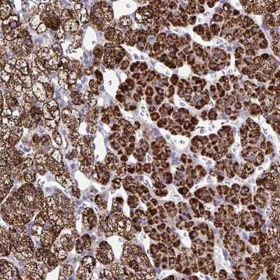 Immunohistochemistry: BCAT2 Antibody [NBP2-33705]