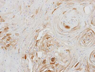 Immunohistochemistry-Paraffin: BCAT2 Antibody [NBP1-32652]