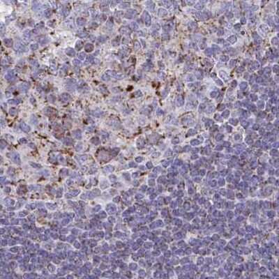 Immunohistochemistry-Paraffin: BCAT2 Antibody [NBP2-33705]