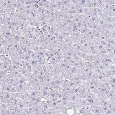Immunohistochemistry-Paraffin: BCAT2 Antibody [NBP2-33705]
