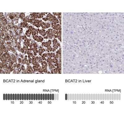 Immunohistochemistry-Paraffin: BCAT2 Antibody [NBP2-33705]